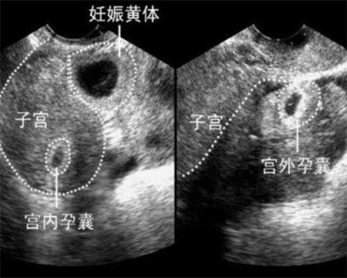 扬州骗子助孕公司如何选择,附详细方法