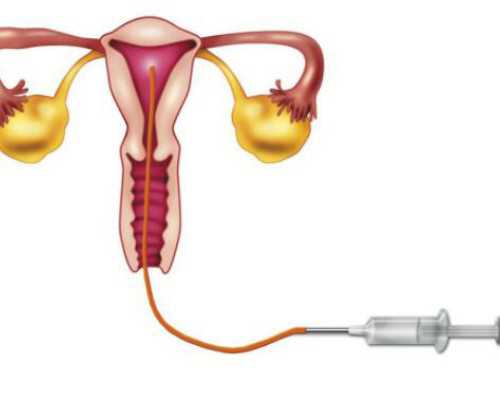 威海试管三代医院-威海供卵三代试管三口之家