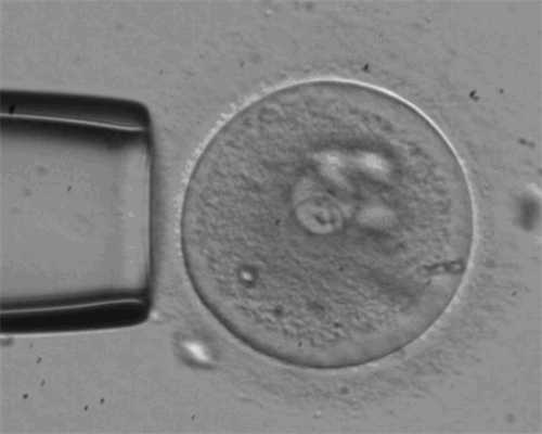<strong>深圳试管婴儿助孕：冷冻精子费用与辅助生殖技术详解</strong>