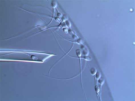 男性进行供卵试管受精需要哪些检查？